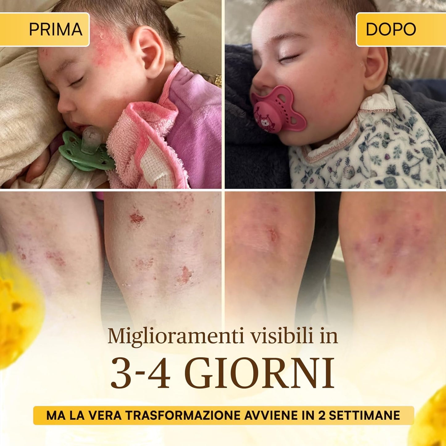 Coccole di Elicriso